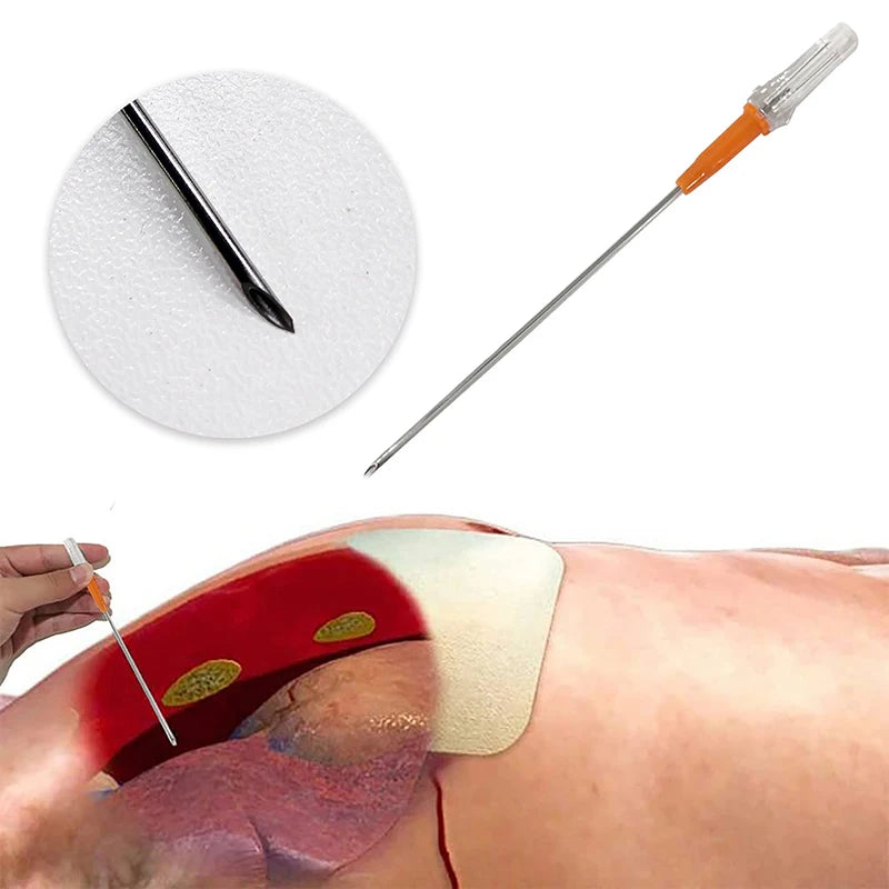 Emergencyequipmentfirstaidkittensionpneumothoraxthoracicneedlemedicalchestdecomp...