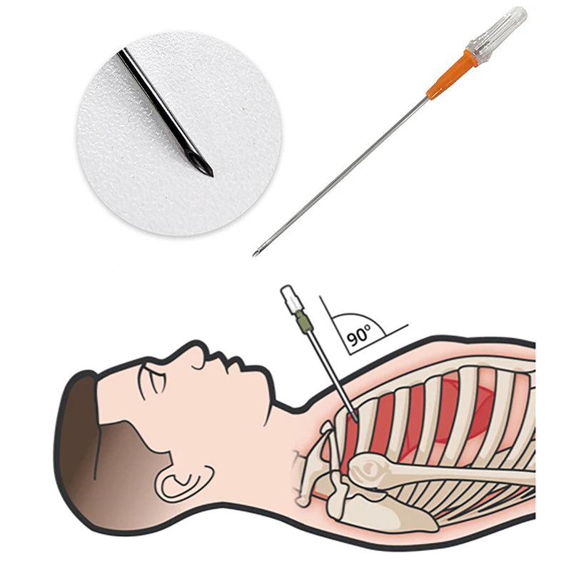 Emergencyequipmentfirstaidkittensionpneumothoraxthoracicneedlemedicalchestdecomp...